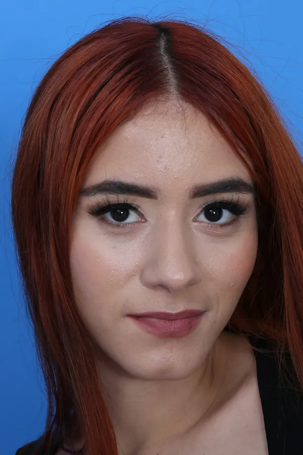 Little Chloe's photo 4